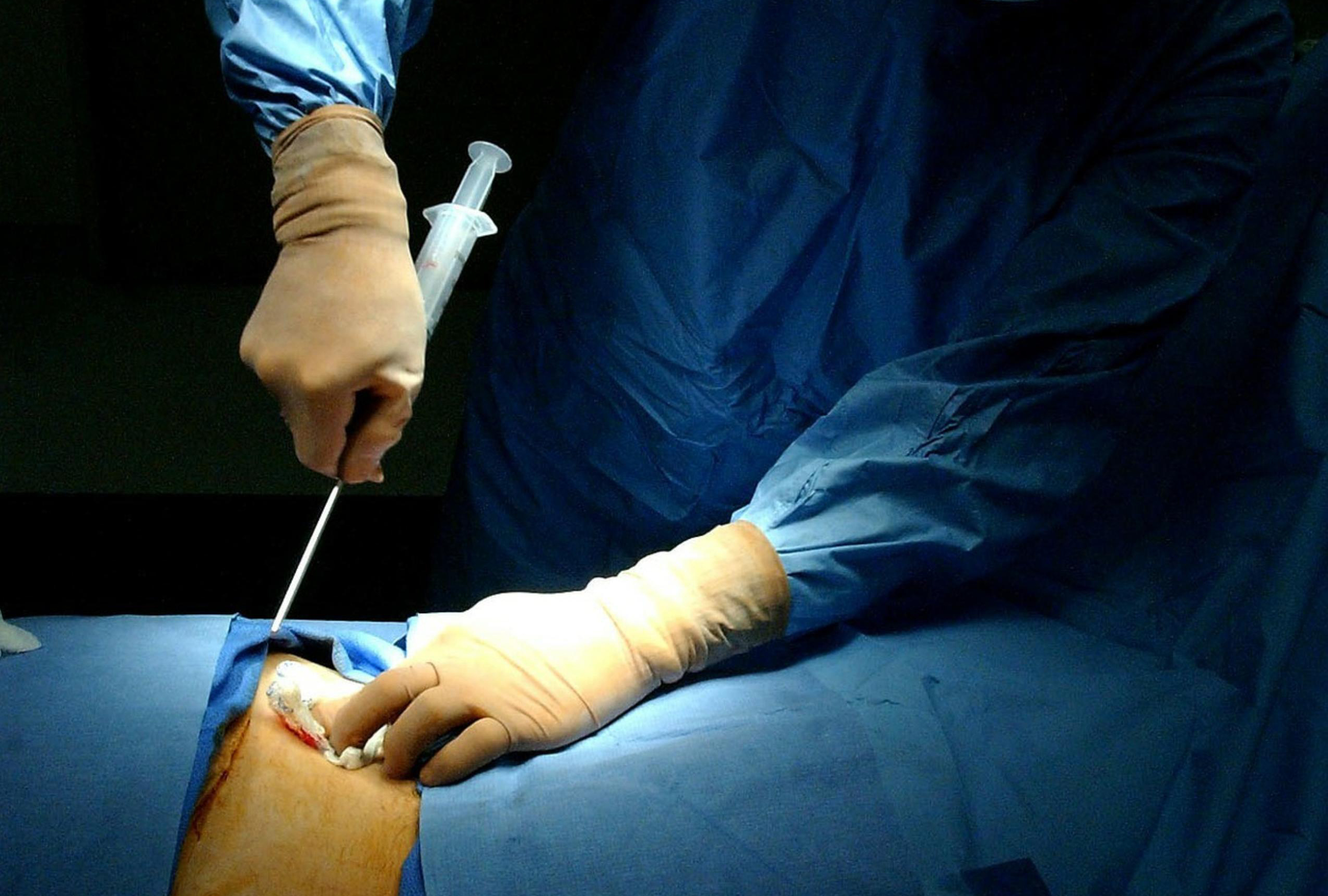 close up of doctor performing injection during medical surgery