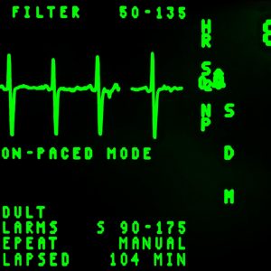 close up of EKG screen