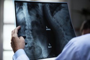 doctor reviewing x ray of injured spine